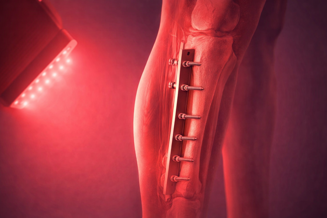 Can I use Red Light Therapy devices with a metal rod and screws in my leg