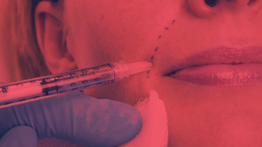 Red Light Therapy After Fillers