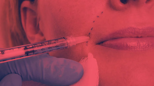 Red Light Therapy After Fillers