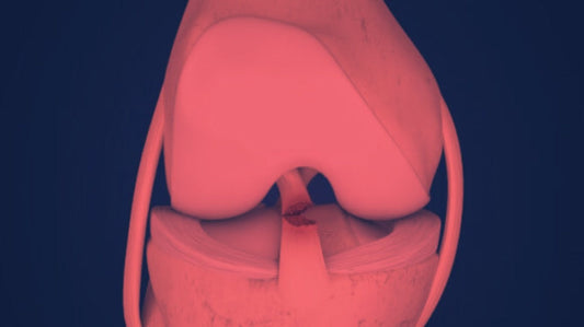 Red Light Therapy for ACL Tear