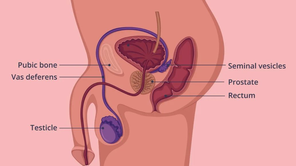 Red Light Therapy for Prostate Cancer