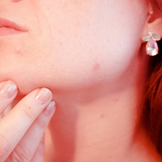 Red Light Therapy For Acne at Home